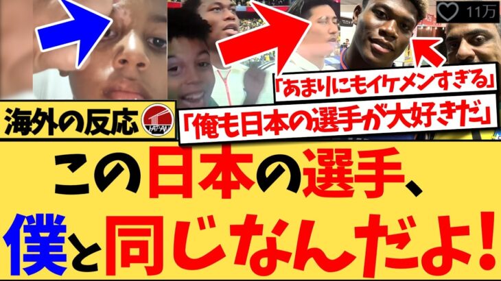 【海外の反応】『みんな、この日本代表の選手、僕と同じあざがあるんだよ！それがすっごくうれしい！』皮膚の一部が白くなってしまう病気で苦しむブラジルの少年が、W杯で伊藤洋輝選手を見つけて大興奮！